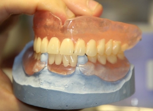Dentures removable and non-removable