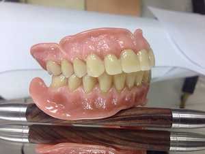 Removable dentures Akri-Free - advantages