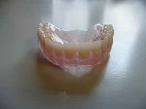 Dental prosthetics - features of removable dentures